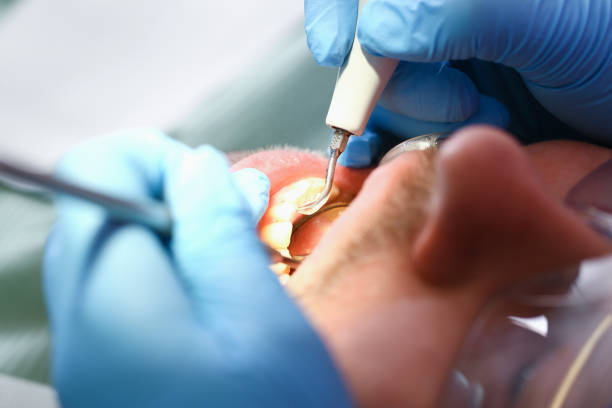 Best Emergency Dental Care for Trauma or Injury in Mount Ivy, NY
