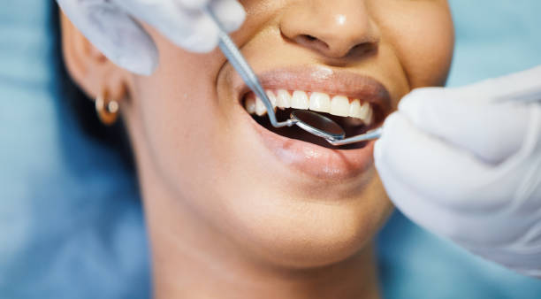 Best Emergency Wisdom Teeth Removal in Mount Ivy, NY